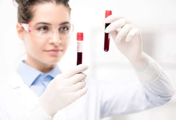 Основные показатели общего анализа крови