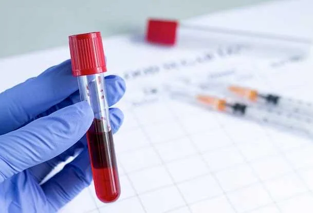 Какие показатели входят в общий анализ крови?