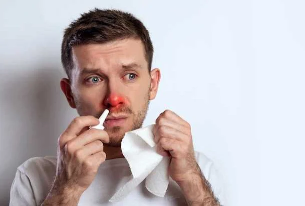 Почему происходит носовое кровотечение и как его предотвратить?