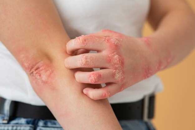 Возможные причины появления красных пятен на коже ребенка